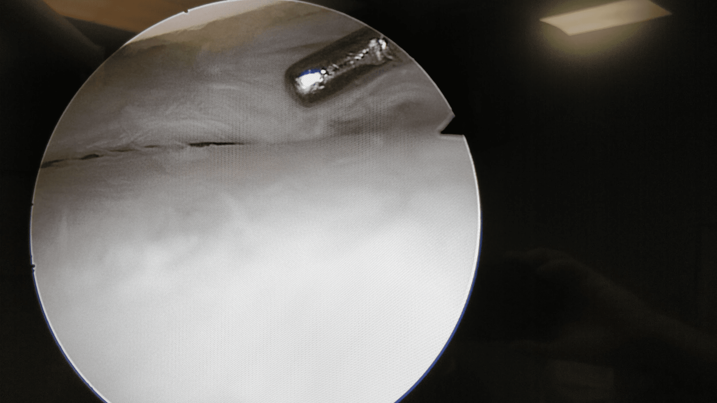 What does the Surgeon do during a Meniscus surgery?
